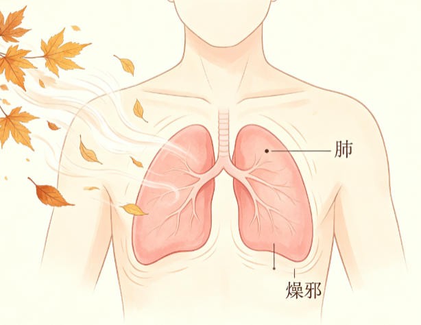 燥邪犯肺