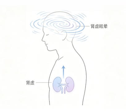 肾虚眩晕