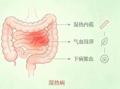 湿热痢
