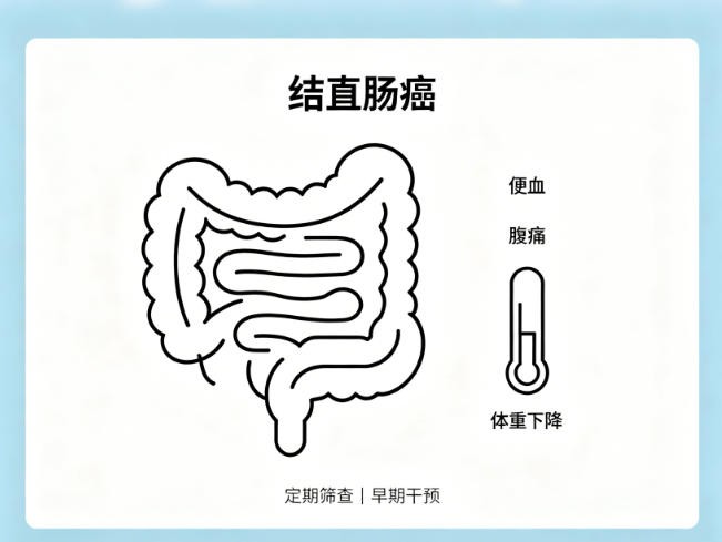结直肠癌