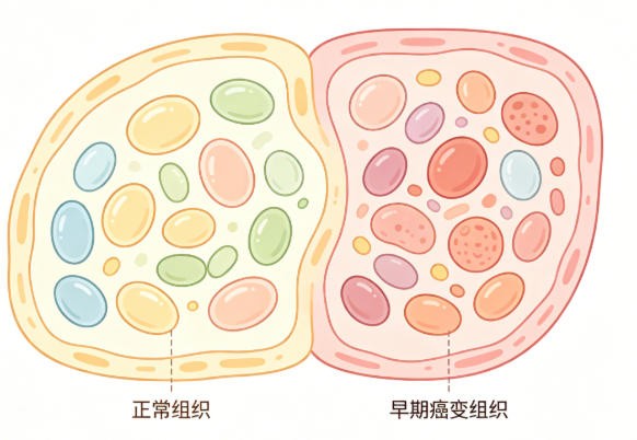 早期癌