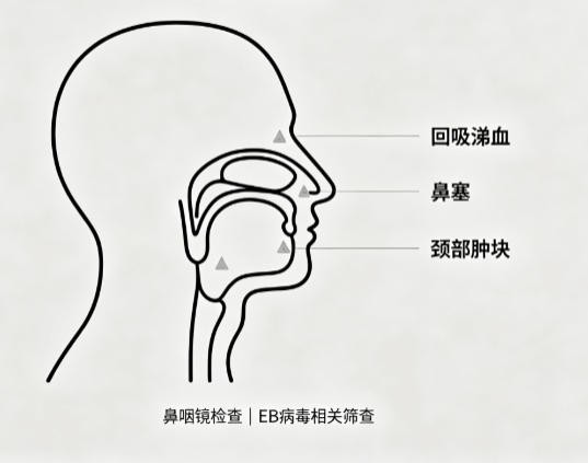 鼻咽癌