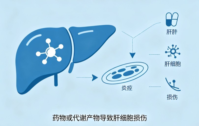 药物性肝损伤