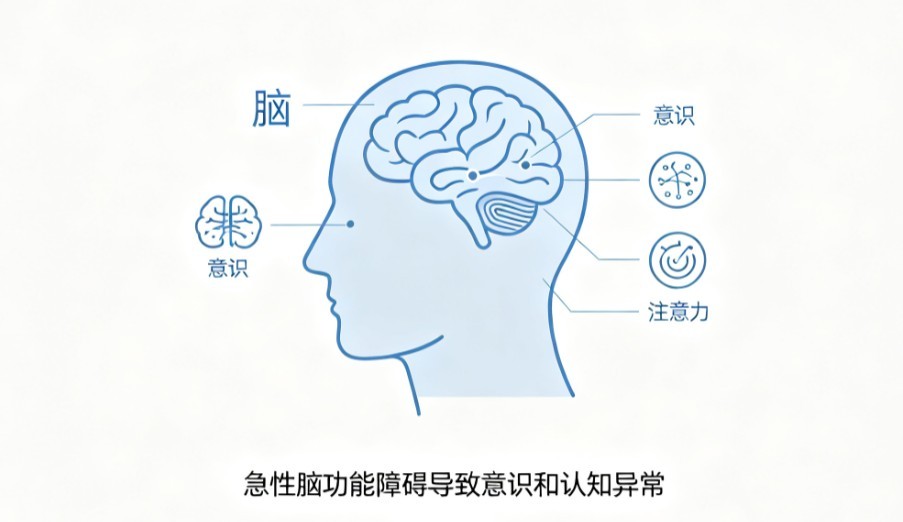 谵妄