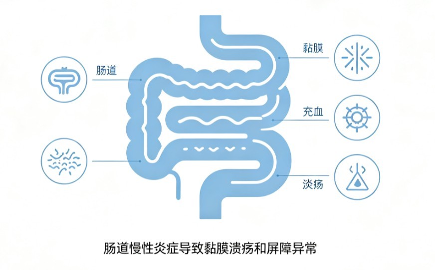 炎症性肠病