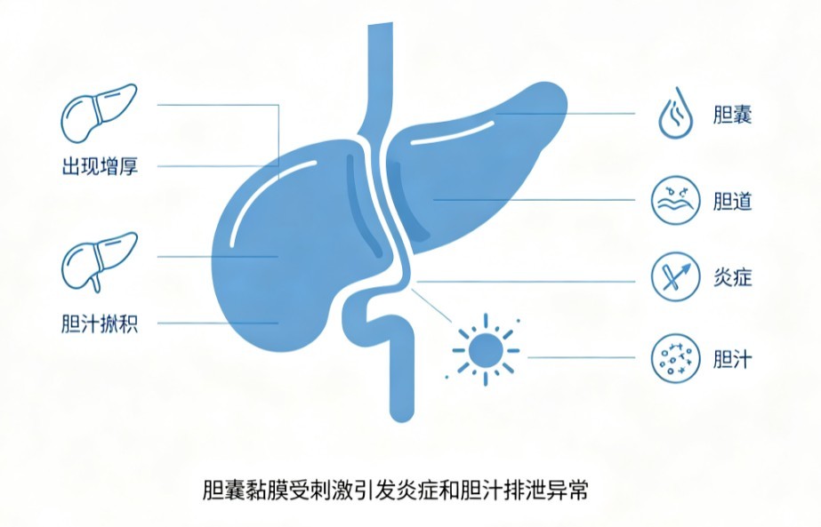 胆囊炎