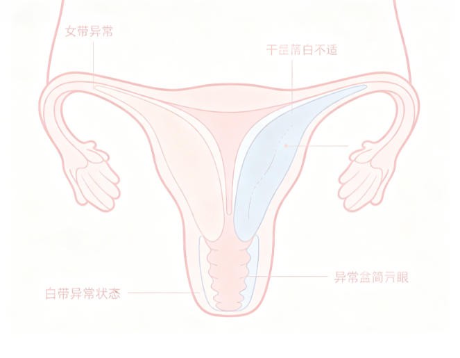 白带异常