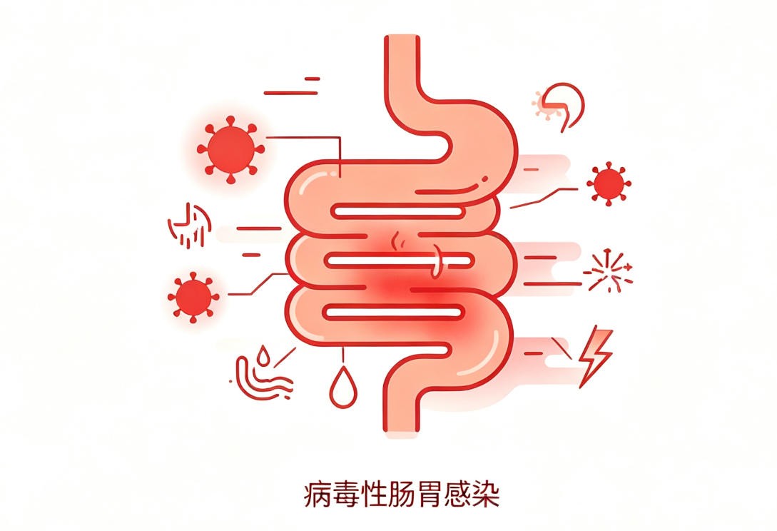 病毒性肠胃感染