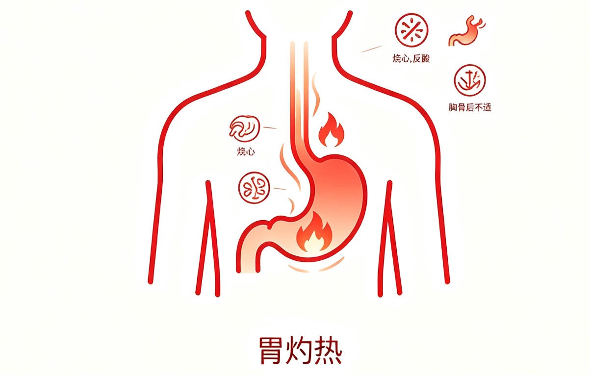 胃灼热