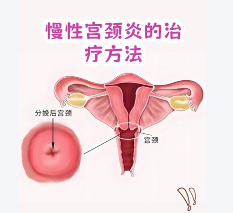 1787207691398693.jpg 屏幕截图 2026-08-20 100951.jpg